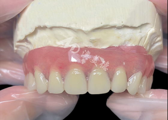 Bom preço Implante de titânio apoiado em barra de fixação Dentes dentários de laboratório dentário da China on-line