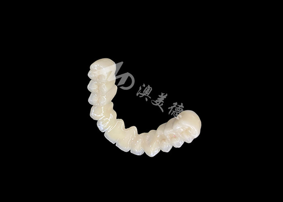 Bom preço Ligação duradoura PFM ponte da coroa dental com excelente biocompatibilidade ligação segura on-line
