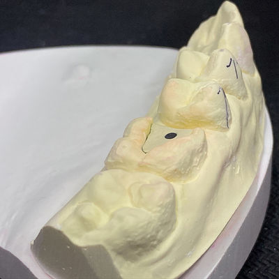 Bom preço Fortaleça sua restauração com a tecnologia Lock Pink Post Core on-line