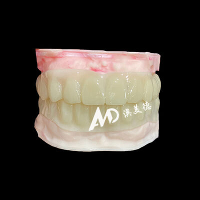 Bom preço PMMA Hollow Temporary Bridges for Implant Provisional Cases on-line