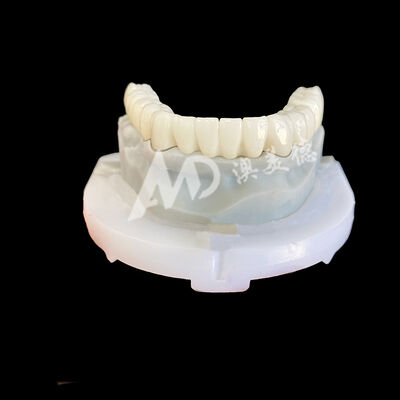 Bom preço Coroa Dentária de Zircônia - Coroa de Porcelana de Alta Resistência para Durabilidade Duradoura, com tonalidade B1 on-line