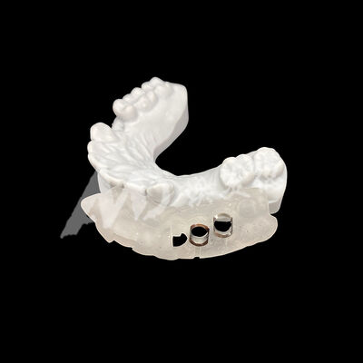 Bom preço Guia de implante cirúrgico impresso em 3D com alta resistência à descoloração usando tecnologia de moagem CAD/CAM on-line