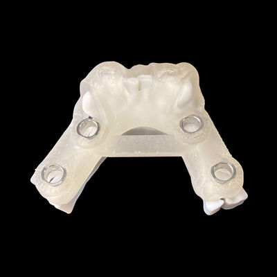 Bom preço Guia Cirúrgica Digital de Implantes com Relatório de Planejamento de Implantes on-line