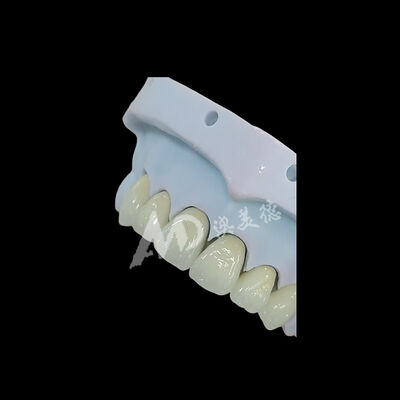 Bom preço Coroa Dentária de Zircônia Monolítica de Contorno Completo On-line